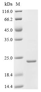 Recombinant Bacillus phage phi29 Single-stranded DNA-binding protein (5) - image 1