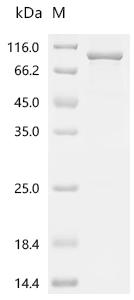 Recombinant Human Prolyl 3-hydroxylase 1 (P3H1) - image 1