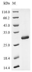 (Tris-Glycine gel) Discontinuous SDS-PAGE (reduced) with 5% enrichment gel and 15% separation gel. (Tris-Glycine gel) Discontinuous SDS-PAGE (reduced) with 5% enrichment gel and 15% separation gel.