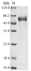 (Tris-Glycine gel) Discontinuous SDS-PAGE (reduced) with 5% enrichment gel and 15% separation gel. (Tris-Glycine gel) Discontinuous SDS-PAGE (reduced) with 5% enrichment gel and 15% separation gel.