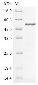 (Tris-Glycine gel) Discontinuous SDS-PAGE (reduced) with 5% enrichment gel and 15% separation gel. (Tris-Glycine gel) Discontinuous SDS-PAGE (reduced) with 5% enrichment gel and 15% separation gel.