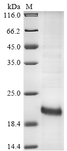 (Tris-Glycine gel) Discontinuous SDS-PAGE (reduced) with 5% enrichment gel and 15% separation gel. (Tris-Glycine gel) Discontinuous SDS-PAGE (reduced) with 5% enrichment gel and 15% separation gel.
