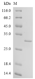 (Tris-Glycine gel) Discontinuous SDS-PAGE (reduced) with 5% enrichment gel and 15% separation gel. (Tris-Glycine gel) Discontinuous SDS-PAGE (reduced) with 5% enrichment gel and 15% separation gel.