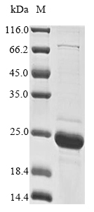 Recombinant Pig Alpha-synuclein (SNCA) - image 1