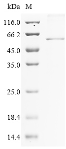 (Tris-Glycine gel) Discontinuous SDS-PAGE (reduced) with 5% enrichment gel and 15% separation gel. (Tris-Glycine gel) Discontinuous SDS-PAGE (reduced) with 5% enrichment gel and 15% separation gel.