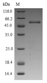 (Tris-Glycine gel) Discontinuous SDS-PAGE (reduced) with 5% enrichment gel and 15% separation gel. (Tris-Glycine gel) Discontinuous SDS-PAGE (reduced) with 5% enrichment gel and 15% separation gel.