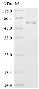 (Tris-Glycine gel) Discontinuous SDS-PAGE (reduced) with 5% enrichment gel and 15% separation gel. (Tris-Glycine gel) Discontinuous SDS-PAGE (reduced) with 5% enrichment gel and 15% separation gel.