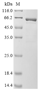 (Tris-Glycine gel) Discontinuous SDS-PAGE (reduced) with 5% enrichment gel and 15% separation gel. (Tris-Glycine gel) Discontinuous SDS-PAGE (reduced) with 5% enrichment gel and 15% separation gel.