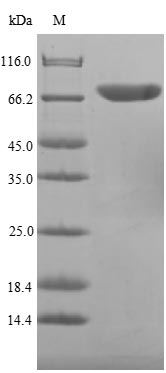 (Tris-Glycine gel) Discontinuous SDS-PAGE (reduced) with 5% enrichment gel and 15% separation gel. (Tris-Glycine gel) Discontinuous SDS-PAGE (reduced) with 5% enrichment gel and 15% separation gel.