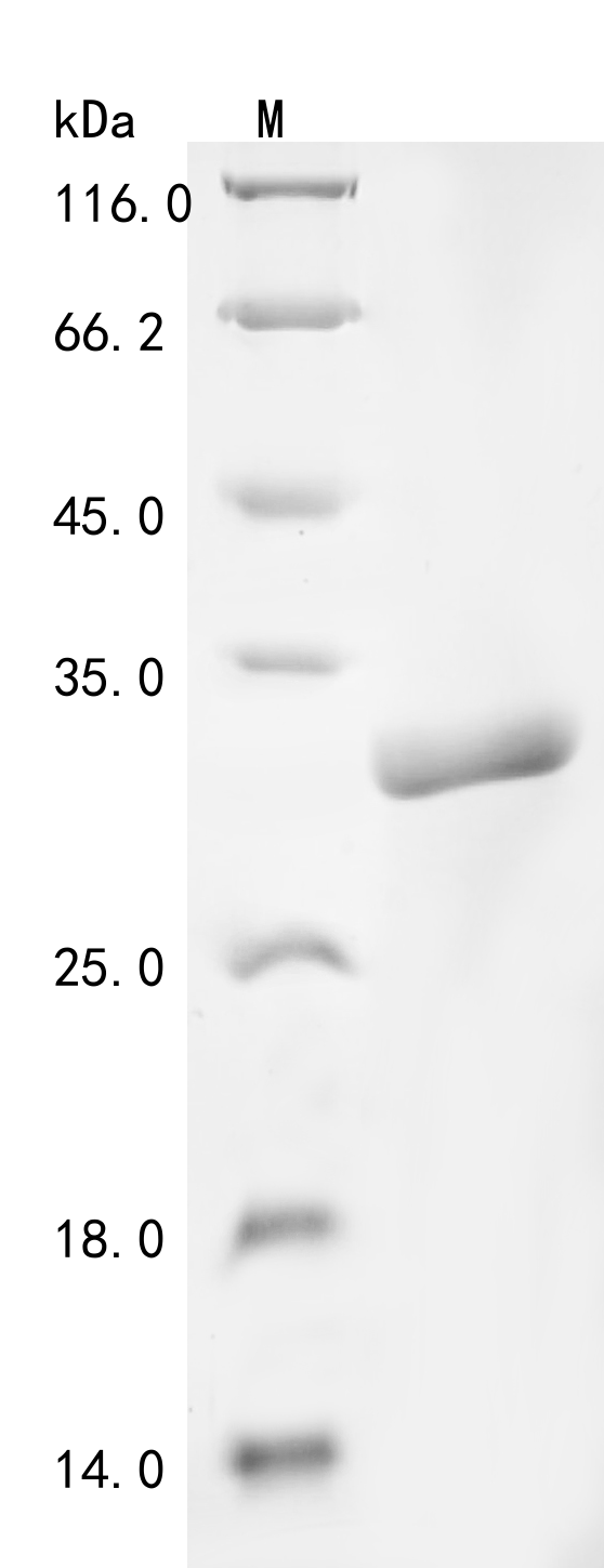 (Tris-Glycine gel) Discontinuous SDS-PAGE (reduced) with 5% enrichment gel and 15% separation gel. (Tris-Glycine gel) Discontinuous SDS-PAGE (reduced) with 5% enrichment gel and 15% separation gel.