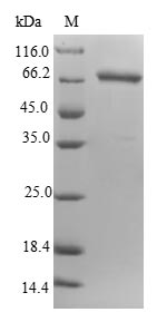 (Tris-Glycine gel) Discontinuous SDS-PAGE (reduced) with 5% enrichment gel and 15% separation gel. (Tris-Glycine gel) Discontinuous SDS-PAGE (reduced) with 5% enrichment gel and 15% separation gel.