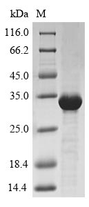 (Tris-Glycine gel) Discontinuous SDS-PAGE (reduced) with 5% enrichment gel and 15% separation gel. (Tris-Glycine gel) Discontinuous SDS-PAGE (reduced) with 5% enrichment gel and 15% separation gel.