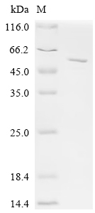 Recombinant Bovine Sorting neXIn-5 (SNX5) - image 1