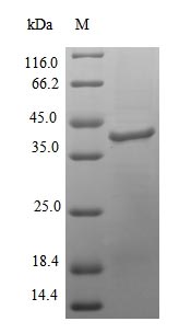 (Tris-Glycine gel) Discontinuous SDS-PAGE (reduced) with 5% enrichment gel and 15% separation gel.
