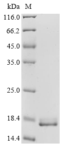 (Tris-Glycine gel) Discontinuous SDS-PAGE (reduced) with 5% enrichment gel and 15% separation gel. (Tris-Glycine gel) Discontinuous SDS-PAGE (reduced) with 5% enrichment gel and 15% separation gel.