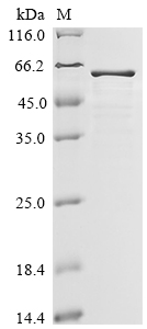 Recombinant Human Filamin A-interacting protein 1-like (FILIP1L) , partial - image 1