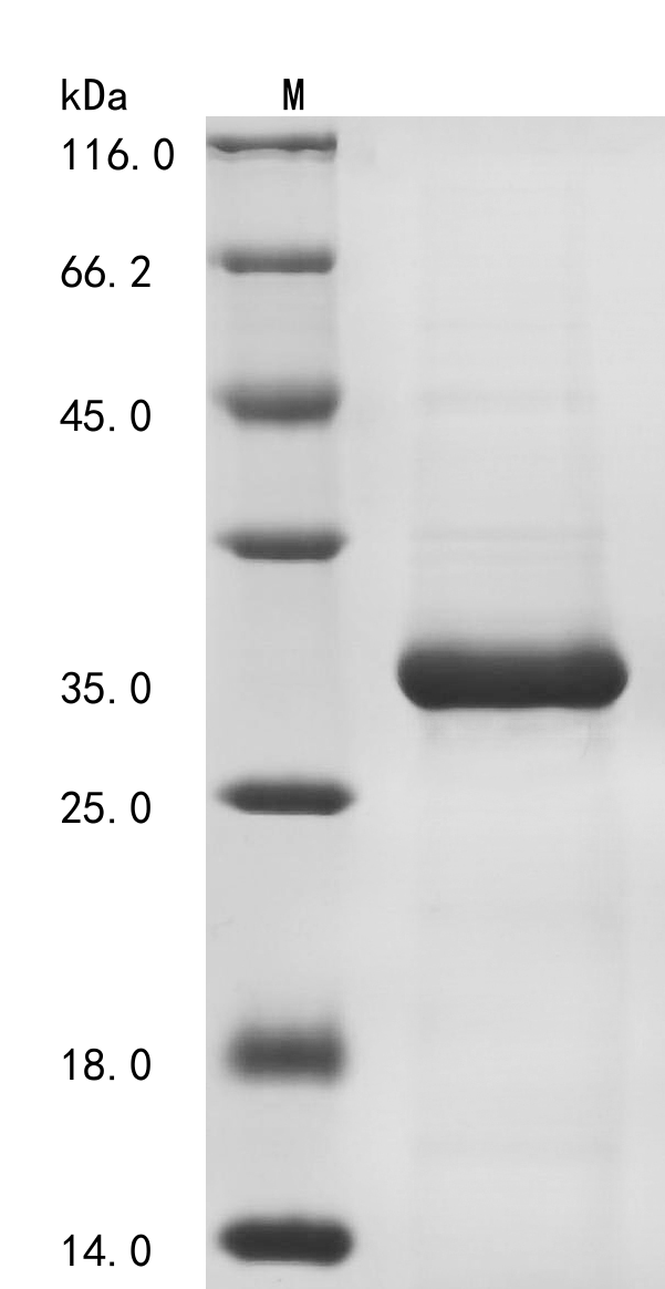 Recombinant Human Filamin A-interacting protein 1-like (FILIP1L) , partial - image 1