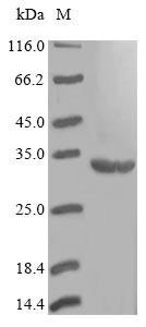 (Tris-Glycine gel) Discontinuous SDS-PAGE (reduced) with 5% enrichment gel and 15% separation gel.