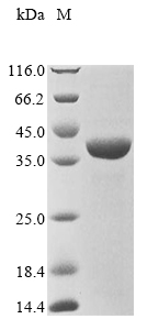 (Tris-Glycine gel) Discontinuous SDS-PAGE (reduced) with 5% enrichment gel and 15% separation gel.