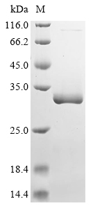 (Tris-Glycine gel) Discontinuous SDS-PAGE (reduced) with 5% enrichment gel and 15% separation gel. (Tris-Glycine gel) Discontinuous SDS-PAGE (reduced) with 5% enrichment gel and 15% separation gel.