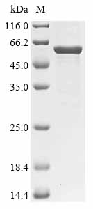 (Tris-Glycine gel) Discontinuous SDS-PAGE (reduced) with 5% enrichment gel and 15% separation gel. (Tris-Glycine gel) Discontinuous SDS-PAGE (reduced) with 5% enrichment gel and 15% separation gel.