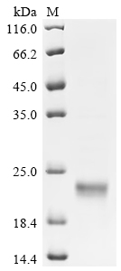 (Tris-Glycine gel) Discontinuous SDS-PAGE (reduced) with 5% enrichment gel and 15% separation gel. (Tris-Glycine gel) Discontinuous SDS-PAGE (reduced) with 5% enrichment gel and 15% separation gel.