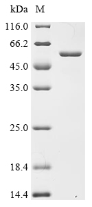 (Tris-Glycine gel) Discontinuous SDS-PAGE (reduced) with 5% enrichment gel and 15% separation gel. (Tris-Glycine gel) Discontinuous SDS-PAGE (reduced) with 5% enrichment gel and 15% separation gel.