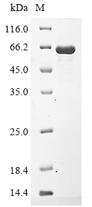 (Tris-Glycine gel) Discontinuous SDS-PAGE (reduced) with 5% enrichment gel and 15% separation gel. (Tris-Glycine gel) Discontinuous SDS-PAGE (reduced) with 5% enrichment gel and 15% separation gel.