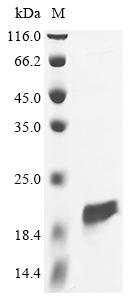 (Tris-Glycine gel) Discontinuous SDS-PAGE (reduced) with 5% enrichment gel and 15% separation gel. (Tris-Glycine gel) Discontinuous SDS-PAGE (reduced) with 5% enrichment gel and 15% separation gel.