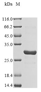 (Tris-Glycine gel) Discontinuous SDS-PAGE (reduced) with 5% enrichment gel and 15% separation gel. (Tris-Glycine gel) Discontinuous SDS-PAGE (reduced) with 5% enrichment gel and 15% separation gel.