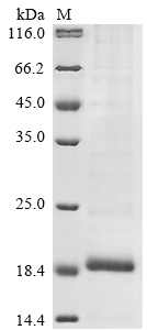 (Tris-Glycine gel) Discontinuous SDS-PAGE (reduced) with 5% enrichment gel and 15% separation gel. (Tris-Glycine gel) Discontinuous SDS-PAGE (reduced) with 5% enrichment gel and 15% separation gel.