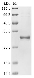 Recombinant Human Spindlin-4 (SPIN4) , partial - image 1