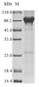 (Tris-Glycine gel) Discontinuous SDS-PAGE (reduced) with 5% enrichment gel and 15% separation gel. (Tris-Glycine gel) Discontinuous SDS-PAGE (reduced) with 5% enrichment gel and 15% separation gel.