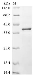 (Tris-Glycine gel) Discontinuous SDS-PAGE (reduced) with 5% enrichment gel and 15% separation gel. (Tris-Glycine gel) Discontinuous SDS-PAGE (reduced) with 5% enrichment gel and 15% separation gel.