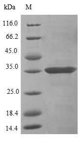 (Tris-Glycine gel) Discontinuous SDS-PAGE (reduced) with 5% enrichment gel and 15% separation gel. (Tris-Glycine gel) Discontinuous SDS-PAGE (reduced) with 5% enrichment gel and 15% separation gel.