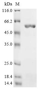 Recombinant Salmonella typhimurium Cell invasion protein sipD (sipD) - image 1