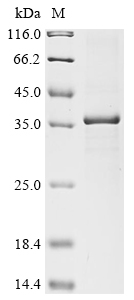 (Tris-Glycine gel) Discontinuous SDS-PAGE (reduced) with 5% enrichment gel and 15% separation gel.