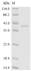 Recombinant Human Adipolin (C1QTNF12) - image 1
