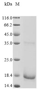 (Tris-Glycine gel) Discontinuous SDS-PAGE (reduced) with 5% enrichment gel and 15% separation gel. (Tris-Glycine gel) Discontinuous SDS-PAGE (reduced) with 5% enrichment gel and 15% separation gel.