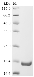 Recombinant Human Anoctamin-1 (ANO1) , partial - image 1