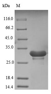 (Tris-Glycine gel) Discontinuous SDS-PAGE (reduced) with 5% enrichment gel and 15% separation gel. (Tris-Glycine gel) Discontinuous SDS-PAGE (reduced) with 5% enrichment gel and 15% separation gel.