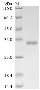 (Tris-Glycine gel) Discontinuous SDS-PAGE (reduced) with 5% enrichment gel and 15% separation gel. (Tris-Glycine gel) Discontinuous SDS-PAGE (reduced) with 5% enrichment gel and 15% separation gel.
