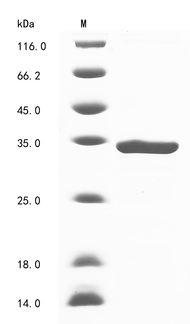 (Tris-Glycine gel) Discontinuous SDS-PAGE (reduced) with 5% enrichment gel and 15% separation gel. (Tris-Glycine gel) Discontinuous SDS-PAGE (reduced) with 5% enrichment gel and 15% separation gel.