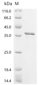 Recombinant Human PX domain-containing protein 1 (PXDC1) - image 1