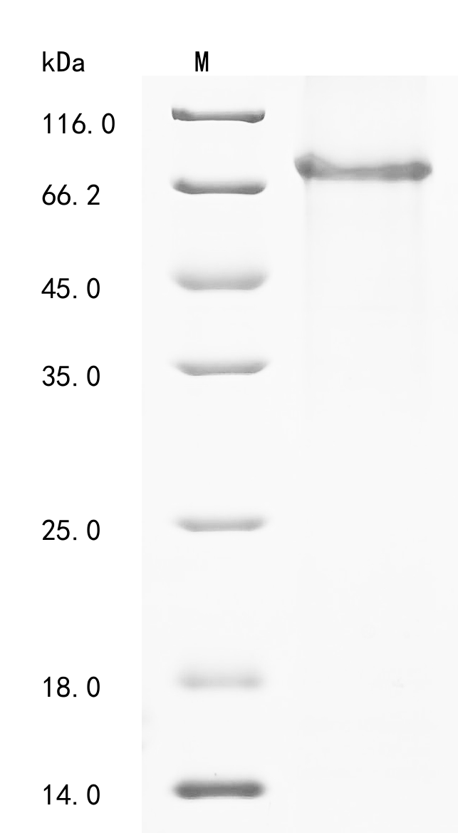 (Tris-Glycine gel) Discontinuous SDS-PAGE (reduced) with 5% enrichment gel and 15% separation gel. (Tris-Glycine gel) Discontinuous SDS-PAGE (reduced) with 5% enrichment gel and 15% separation gel.