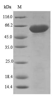 (Tris-Glycine gel) Discontinuous SDS-PAGE (reduced) with 5% enrichment gel and 15% separation gel. (Tris-Glycine gel) Discontinuous SDS-PAGE (reduced) with 5% enrichment gel and 15% separation gel.