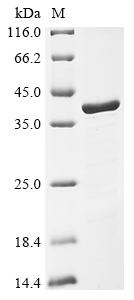 (Tris-Glycine gel) Discontinuous SDS-PAGE (reduced) with 5% enrichment gel and 15% separation gel. (Tris-Glycine gel) Discontinuous SDS-PAGE (reduced) with 5% enrichment gel and 15% separation gel.