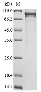 (Tris-Glycine gel) Discontinuous SDS-PAGE (reduced) with 5% enrichment gel and 15% separation gel. (Tris-Glycine gel) Discontinuous SDS-PAGE (reduced) with 5% enrichment gel and 15% separation gel.