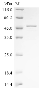 (Tris-Glycine gel) Discontinuous SDS-PAGE (reduced) with 5% enrichment gel and 15% separation gel. (Tris-Glycine gel) Discontinuous SDS-PAGE (reduced) with 5% enrichment gel and 15% separation gel.