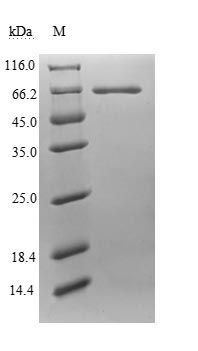 SDS-PAGE- Recombinant protein Human ERVK6